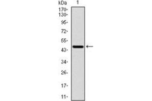 Western Blotting (WB) image for anti-Ribosomal Protein S6 Kinase, 70kDa, Polypeptide 1 (RPS6KB1) antibody (ABIN1108904) (RPS6KB1 anticorps)