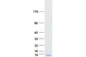 Validation with Western Blot