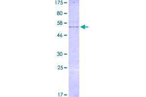 Image no. 1 for RNA-Binding Region (RNP1, RRM) Containing 3 (RNPC3) (AA 1-261) protein (GST tag) (ABIN1318413)