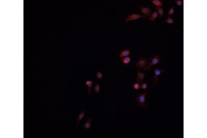 ABIN6269016 staining HeLa cells by IF/ICC. (Ku70/80 anticorps)