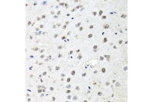 Immunohistochemistry of paraffin-embedded mouse brain using AGO2 antibody (ABIN5974124) at dilution of 1/100 (40x lens). (AGO2 anticorps)