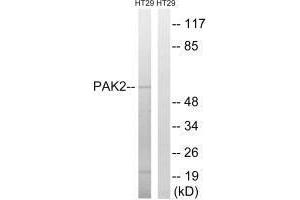 Western blot analysis of extracts from HT-29 cells, using PAK2 (Ab-197) antibody. (PAK2 anticorps  (Ser62))