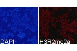 Immunofluorescence analysis of 293T cell using H3R2me2a antibody. (Histone 3 anticorps  (H3R2me2a))