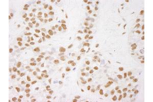 anti-Cofactor of BRCA1 (COBRA1) (AA 530-580) antibody