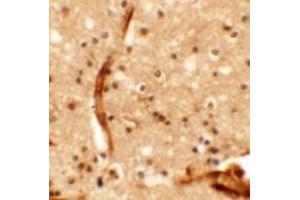 Immunohistochemistry of KCNK13 in human brain tissue with KCNK13 antibody at 5 ug/mL. (KCNK13 anticorps  (Middle Region))