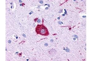 Immunohistochemical staining of Brain (Neuron) using anti- GPR116 antibody ABIN122116 (G Protein-Coupled Receptor 116 anticorps  (Cytoplasmic Domain))