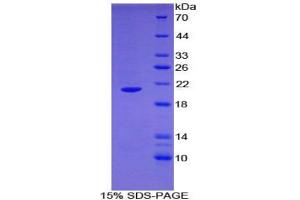 SDS-PAGE analysis of Human ARPC4 Protein. (ARPC4 Protéine)