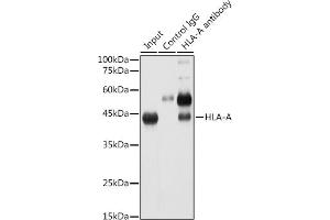 Immunoprecipitation analysis of 300 μg extracts of HeLa cells using 3 μg HLA-A antibody (ABIN7268366).