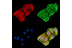 ABIN6258570 and ABIN6274563 staining Hela cells by IF/ICC.