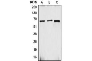 Western blot analysis of gp91 phox expression in HepG2 (A), Caco2 (B), MCF7 (C) whole cell lysates. (CYBB anticorps  (C-Term))