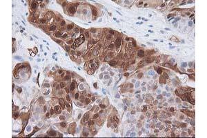 Image no. 3 for anti-Hydroxyprostaglandin Dehydrogenase 15-(NAD) (HPGD) antibody (ABIN1496363) (HPGD anticorps)