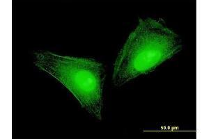 Immunofluorescence of monoclonal antibody to S100A11 on HeLa cell.