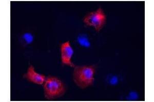 Vimentin antibody used at a dilution of 1:400 to detect COS7 cells. (Vimentin anticorps  (N-Term))