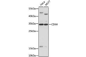 Western blot analysis of extracts of various cell lines, using CDK4 antibody.