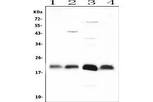 Western blot analysis of FGF21 using anti-FGF21 antibody (ABIN4886586).