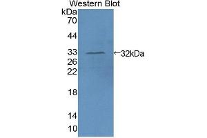 Western blot analysis of the recombinant protein. (AIM1 anticorps  (AA 1502-1719))