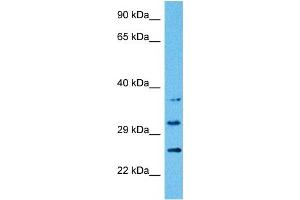 Host:  Rat  Target Name:  ATP1B1  Sample Tissue:  Rat Brain  Antibody Dilution:  1ug/ml