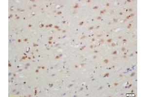 Formalin-fixed and paraffin embedded rat brain labeled with Rabbit Anti-TXNIP Polyclonal Antibody, Unconjugated  at 1:200 followed by conjugation to the secondary antibody and DAB staining (TXNIP anticorps  (AA 101-200))