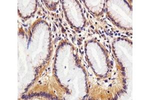 Immunohistochemical analysis of paraffin-embedded human stomach section using RAC1 antibody at 1:25 dilution.