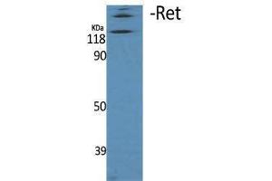Western Blotting (WB) image for anti-Ret Proto-Oncogene (RET) (Thr77) antibody (ABIN3180294) (Ret Proto-Oncogene anticorps  (Thr77))