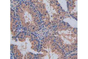 Used in DAB staining on fromalin fixed paraffin- embedded Kidney tissue