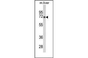 Western blot analysis of GBE1 Antibody (Center) in mouse liver tissue lysates (35ug/lane).