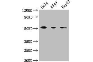 Western Blot Positive WB detected in: Hela whole cell lysate, A549 whole cell lysate, HepG2 whole cell lysate All lanes: CD14 antibody at 1:1800 Secondary Goat polyclonal to Mouse IgG at 1/10000 dilution Predicted band size: 41 kDa Observed band size: 55 kDa