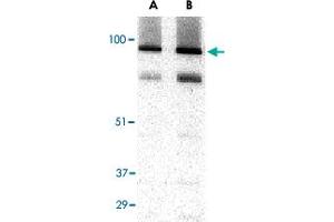 Western blot analysis of TRPC3 in human brain tissue lysate with TRPC3 polyclonal antibody  at (A) 1 and (B) 2 ug/mL . (TRPC3 anticorps  (C-Term))