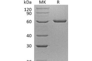 Western Blotting (WB) image for Proprotein Convertase Subtilisin/kexin Type 9 (PCSK9) protein (His tag) (ABIN7320631)