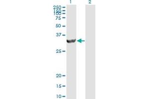 Western Blot analysis of PSME2 expression in transfected 293T cell line by PSME2 monoclonal antibody (M02), clone 1G4.