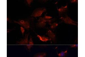 Immunofluorescence analysis of C6 cells using TYMS Polyclonal Antibody at dilution of 1:100. (TYMS anticorps)