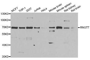 Western blot analysis of extracts of various cell lines, using RNGTT antibody. (RNGTT anticorps  (AA 1-260))