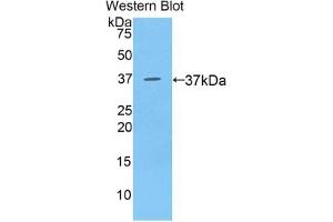 Detection of Recombinant BLC1, Rat using Polyclonal Antibody to B-Lymphocyte Chemoattractant (BLC) (CXCL13 anticorps  (AA 22-108))