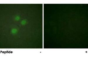 Immunofluorescence analysis of HUVEC cells, using MKI67IP polyclonal antibody . (NIFK anticorps)