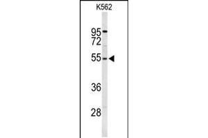 Western blot analysis of RPS6KB2 Antibody in K562 cell line lysates (35ug/lane) (RPS6KB2 anticorps)