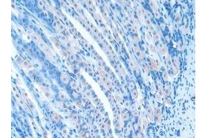 Detection of RSPO1 in Mouse Stomach Tissue using Polyclonal Antibody to R-Spondin 1 (RSPO1)