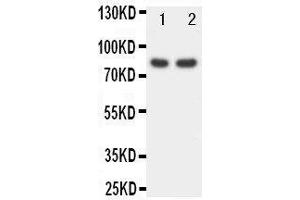 Anti-FOXP1 antibody, Western blotting Lane 1: Rat Spleen Tissue Lysate Lane 2: COLO320 Cell Lysate (FOXP1 anticorps  (C-Term))