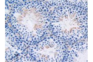 IHC-P analysis of Mouse Testis Tissue, with DAB staining. (CAPNL1 anticorps  (AA 387-694))