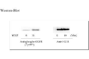 Image no. 4 for Epidermal Growth Factor Receptor (EGFR) ELISA Kit (ABIN625225) (EGFR Kit ELISA)