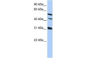 WB Suggested Anti-GJA8 Antibody Titration:  0. (GJA8 anticorps  (Middle Region))