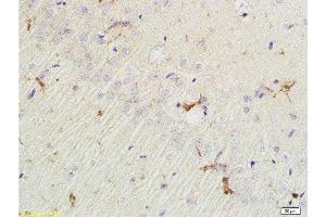 Formalin-fixed and paraffin embedded rat brain labeled with Rabbit Anti EphA7/Eph receptor A7 Polyclonal Antibody, Unconjugated  at 1:200 followed by conjugation to the secondary antibody and DAB staining (EPH Receptor A7 anticorps  (AA 181-280))