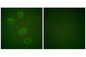 Immunofluorescence analysis of HuvEc cells, using Tyrosine Hydroxylase (Phospho-Ser19) antibody. (Tyrosine Hydroxylase anticorps  (pSer19))