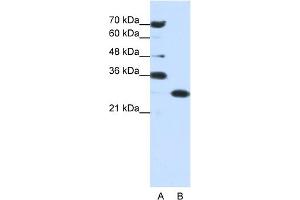 WB Suggested Anti-ANP32A Antibody Titration:  0. (PHAP1 anticorps  (Middle Region))
