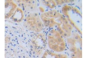 DAB staining on IHC-P; Samples: Human Kidney Tissue (RNF112 anticorps  (AA 73-322))