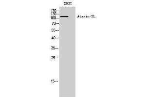 Western Blotting (WB) image for anti-Ataxin 2-Like (ATXN2L) (Internal Region) antibody (ABIN3180503) (Ataxin 2-Like anticorps  (Internal Region))