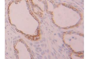 IHC-P analysis of Rat Ovary Tissue, with DAB staining. (Cytokeratin 7 anticorps  (AA 255-393))