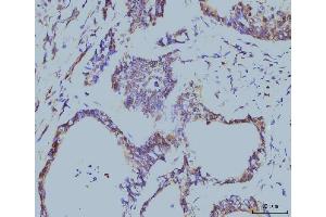 IHC analysis of Cyclophilin E/PPIE using anti-Cyclophilin E/PPIE antibody (ABIN7599243). (PPIE anticorps  (AA 1-301))