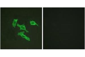 Immunofluorescence analysis of HepG2 cells, using EGFR (Ab-1016) Antibody. (EGFR anticorps  (AA 986-1035))