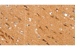 Immunohistochemistry of paraffin-embedded Human brain tissue using SLC25A12 Polyclonal Antibody at dilution 1:30