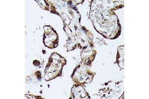 Immunohistochemistry of paraffin-embedded human placenta using MAK antibody (ABIN7268382) at dilution of 1:100 (40x lens).